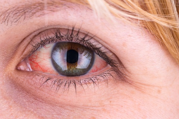 Knowing When Emergency Eye Care Is Needed